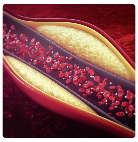 Increase Blood Circulation