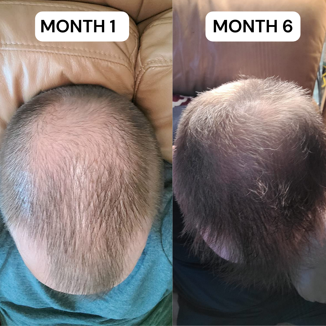 MAXORA VITAFOAM ™ Hair Growth Formula